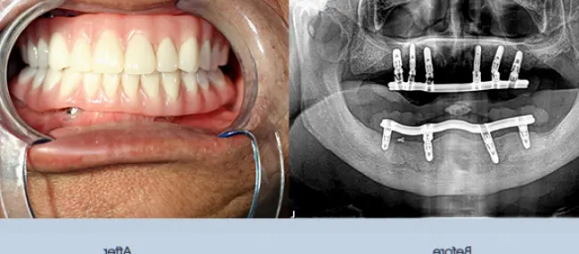 Redwood City Redwood Advanced Dental care