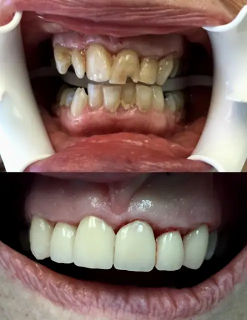Commack Family Dental