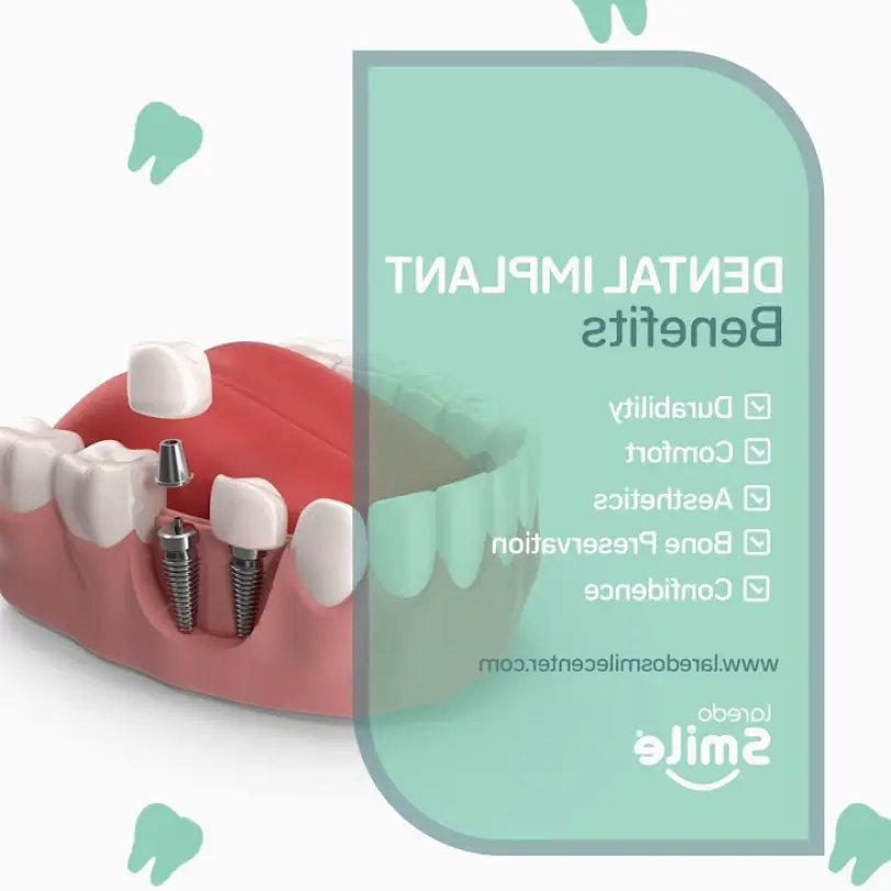 Nuevo Laredo Laredo Smile Center, Clínica Dental e Implantes Dentales.