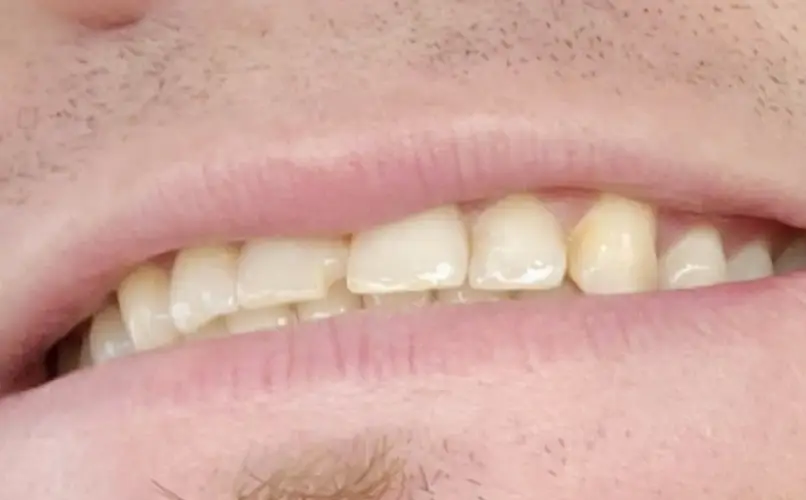 Willoughby Hills Dr. Phillip W. Wallace, DDS
