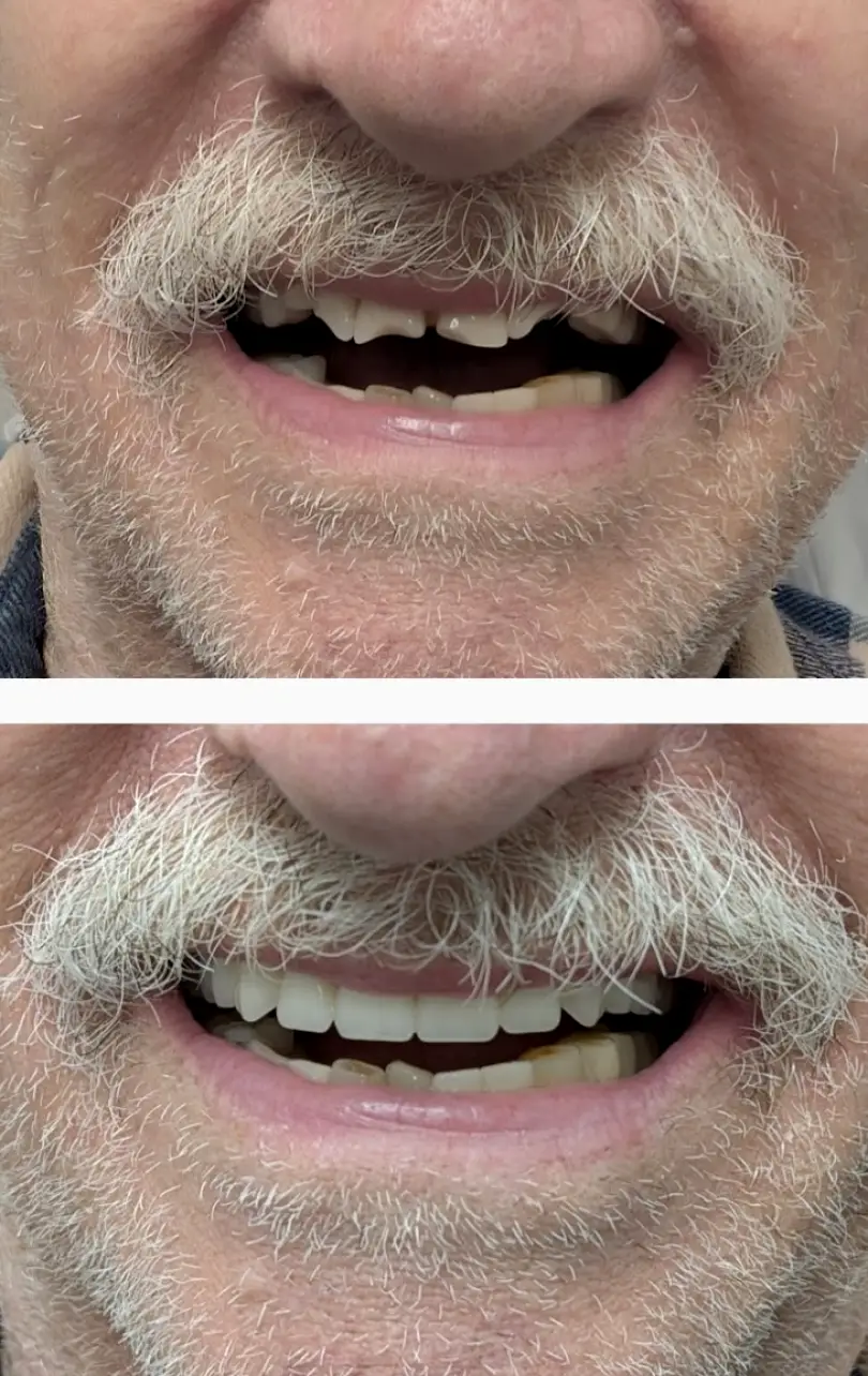 Clarksville Dentures & Implants