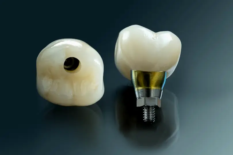 Hayden Golden Dental Laboratory