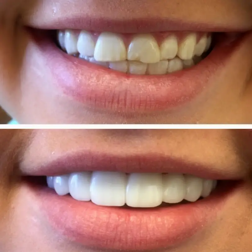  Maryam Hadian, DDS | Le Chic Dentist Los Angeles, CA