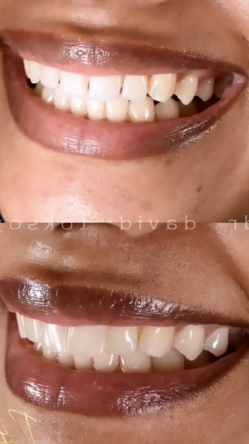  New York Dr. Toksoy | Studio Dental NY | Minimally Invasive Esthetic and Implant Dentistry
