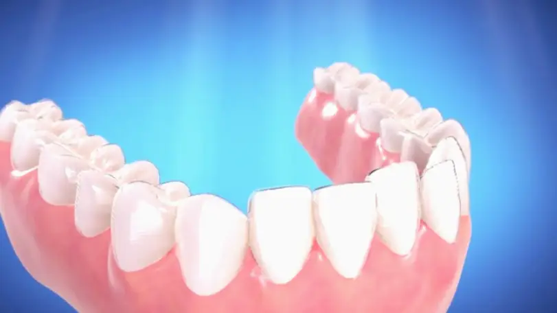 Key West Island Dental