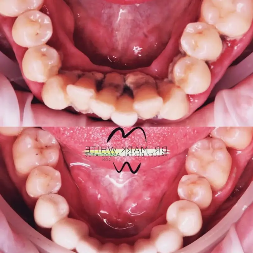 Bullhead City Dr. Mark White-Valley Dental Associates