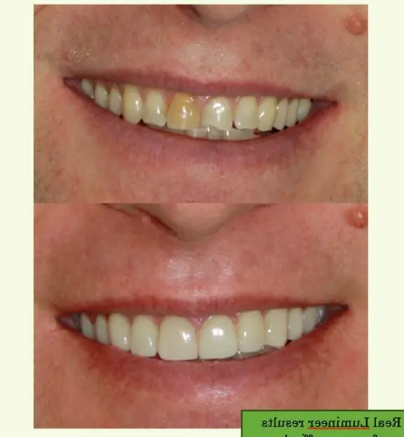 Schererville Forest Ridge Family Dentistry