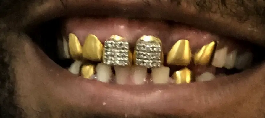 St. Louis Coleman Dental