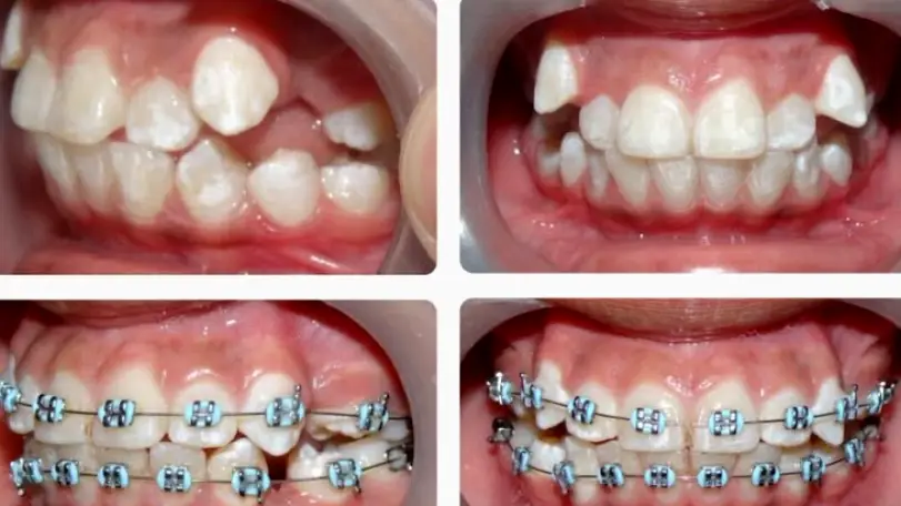 Whittier Heavenly Dental Smiles Inc.
