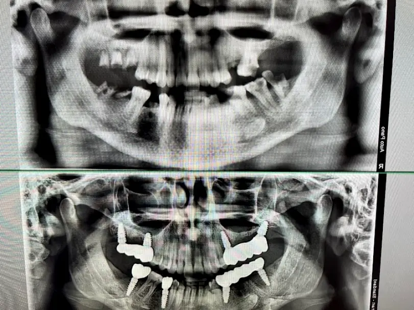 Wilmington Myrtle Grove Implant and Family Dentistry