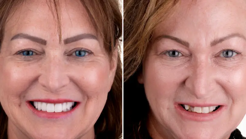 Nolensville The Burkitt Center For Comprehensive Dentistry