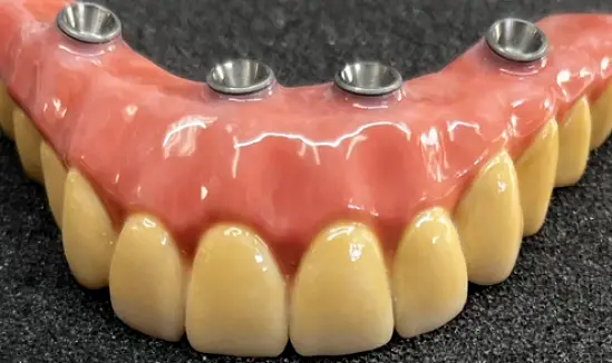 Payson Hybrid Specialists Dental Laboratory