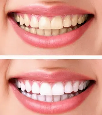 Holt Family Dentistry - Dr. Sandeep Sood, DDS