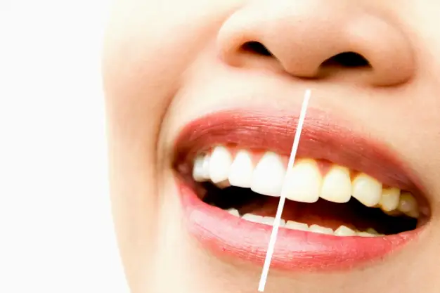 Island Dental - Dentist Gilbert, AZ
