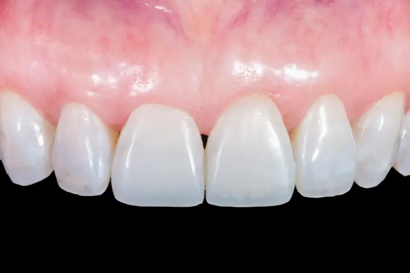 Pleasanton DDS With A Smile : Dr. Helmbold
