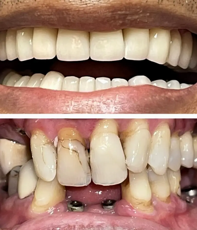 Chantilly Mina Modaresi DDS PC - Regal Dental Care