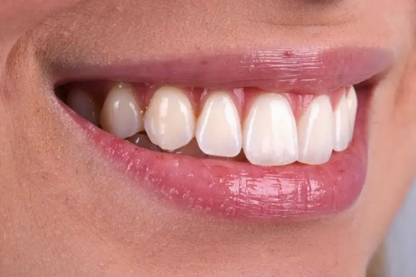  Dallas Texas Dental Solutions Dr. Mireya Imitola D.D.S & Dr. Bruce Barbash D.D.S.
