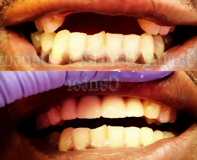 Bossier City Cratisa Caldwell DDS & William Bolinger DDS
