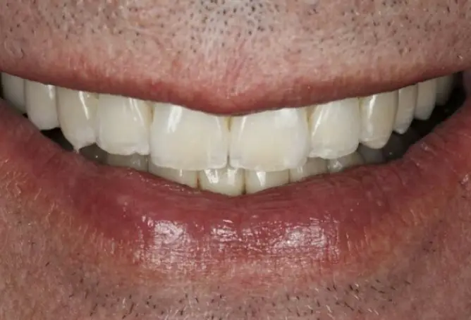Boston Prosthodontics Dental Group