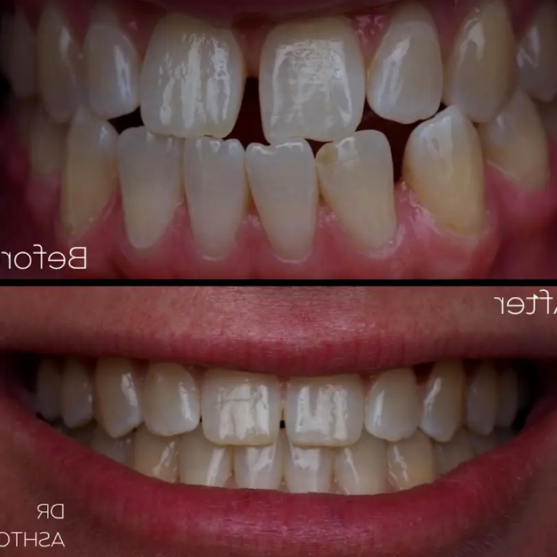 Delray Beach Coastline Family Dental