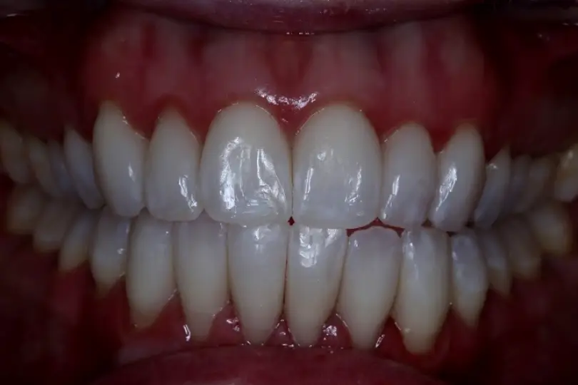 Waxahachie Craig V Smith DDS