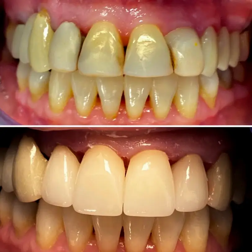 Indiana East Market Family Dental, PLLC