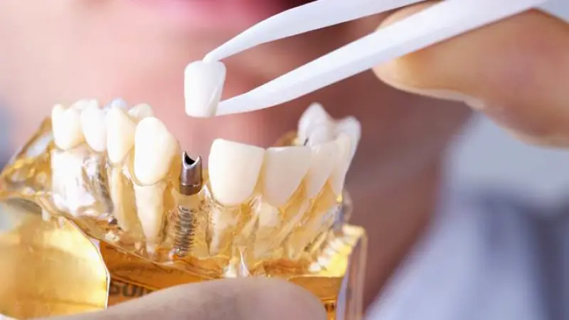 Laser and Cosmetic Dental Center of Boca Raton
