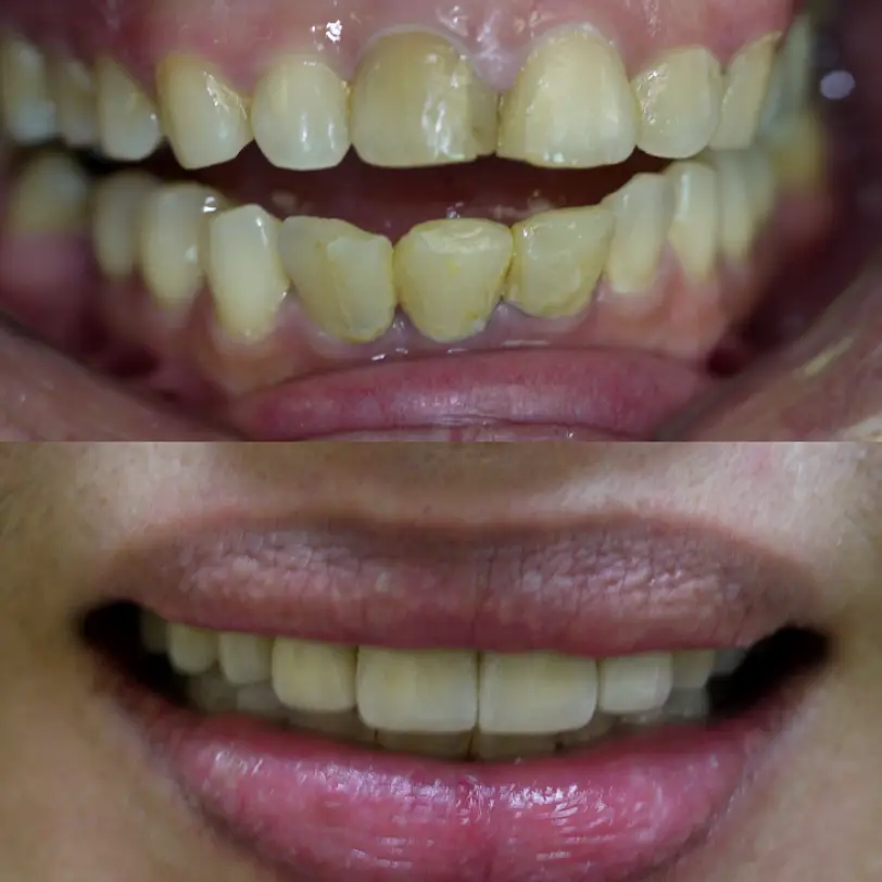 Milpitas Classique Dental Care