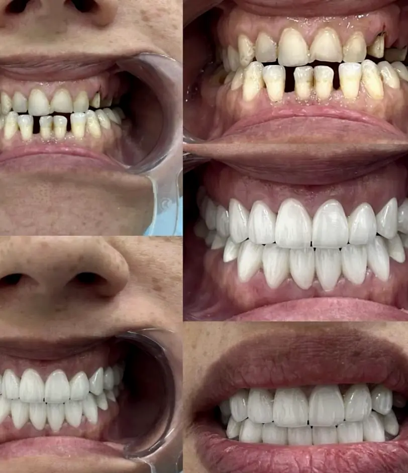 Nuevo Progreso Eagle Dental Clinic