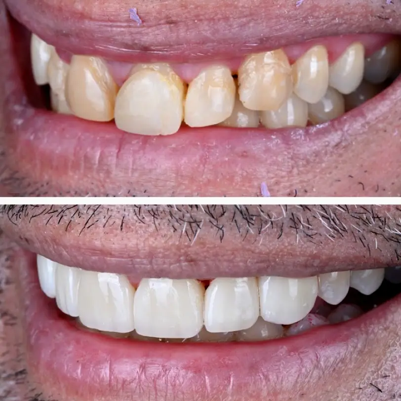 Ocean Township West Park Dental