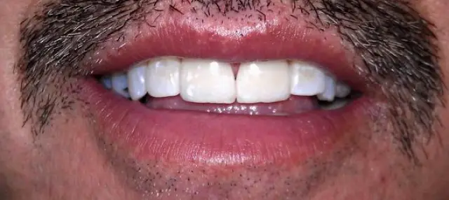 Albuquerque Dr. Pavlakos General & Cosmetic Dentistry