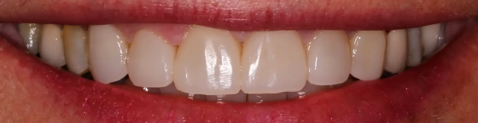 Minocqua Lakeland Dental Care