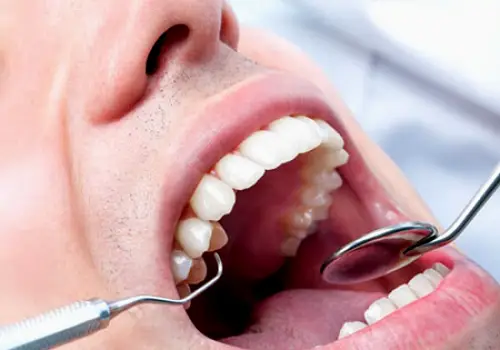 Aava Dental Chino