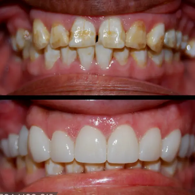 Round Rock Mays Street Dental: Teresa Santana, DDS