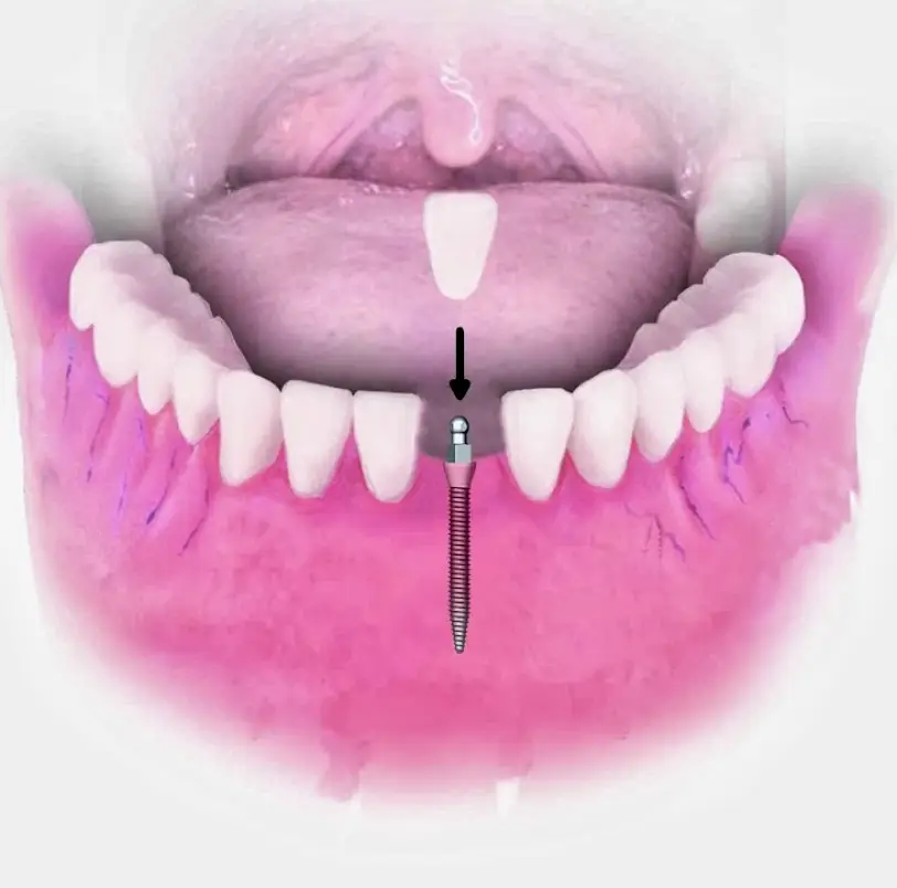 Bloomfield Keep Smiling Hartford Dental Implant Center