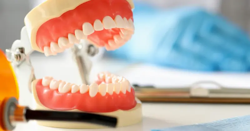 Delmar Dental Plate