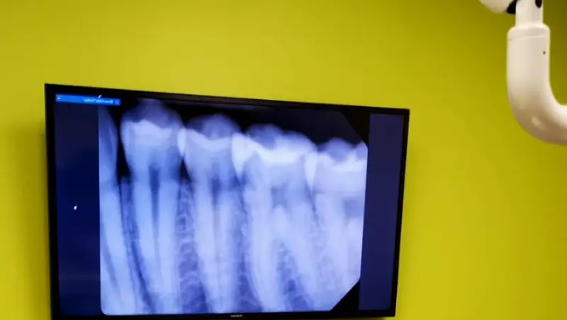 Fresh Dental Huntersville NC