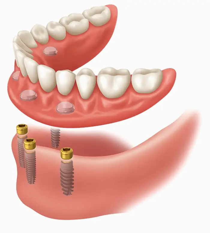Huber Heights Dayton Dental Group