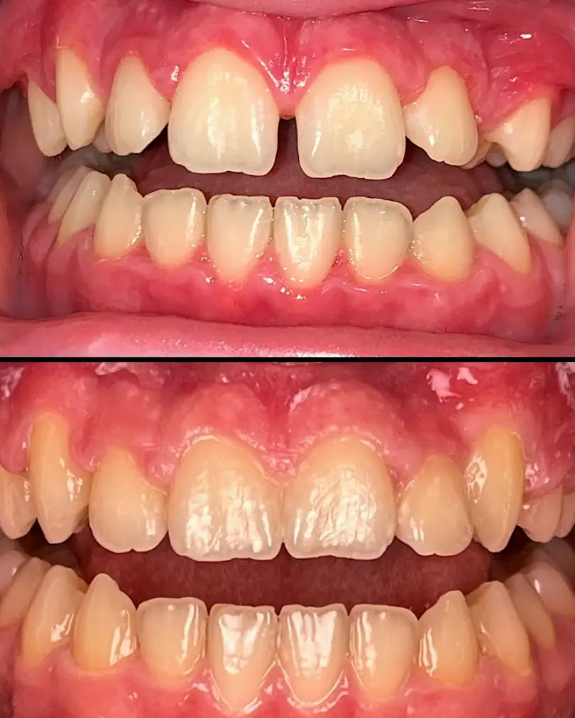 Rapid City Smiles: Implant & Family Dentistry