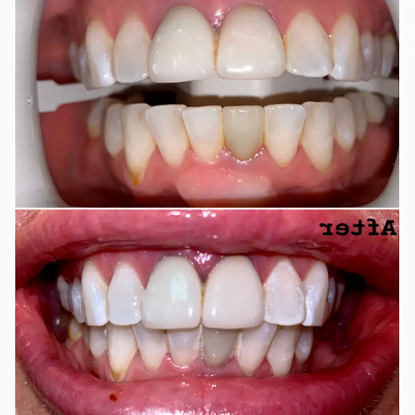 St. George Place Yorktown Dental Spa