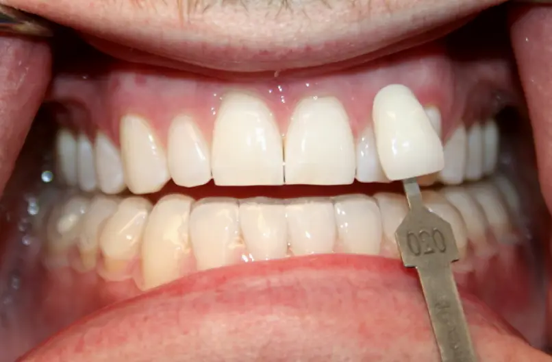 Denville Aesthetic Family Dentistry, PA