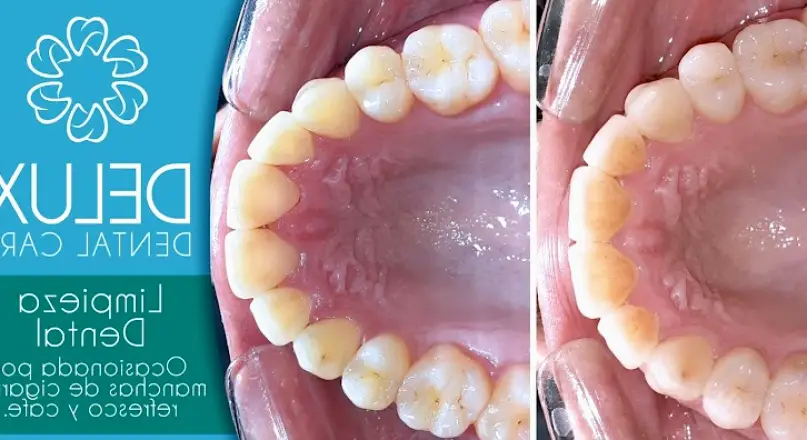 Nuevo Laredo Delux Dental Care