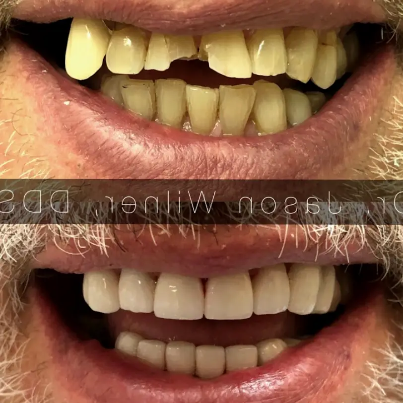  Pompano Beach Florida Coast Dental