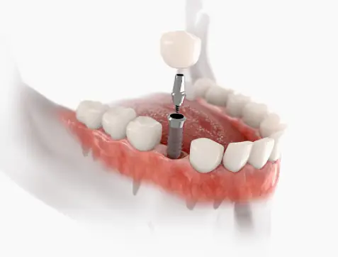 Roanoke Urgent Dentistry Service