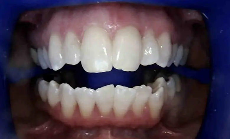 Garner Moore Family Dentistry: Adam Moore, DDS