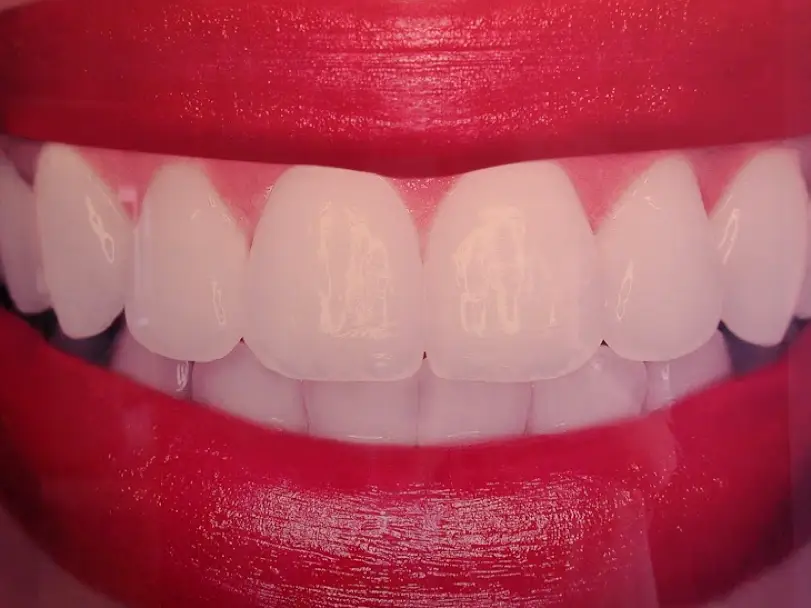 Laurich Dentistry Canton - Douglas A. Callow, DDS