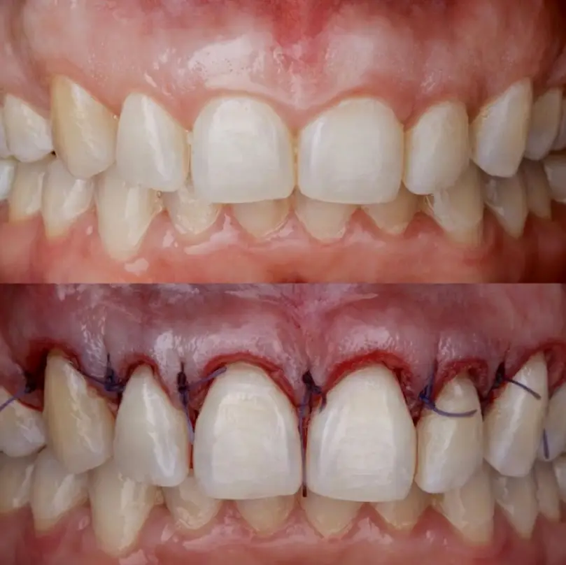 Los Algodones Easy Dental