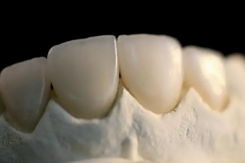 Albuquerque Impress Dental Studio
