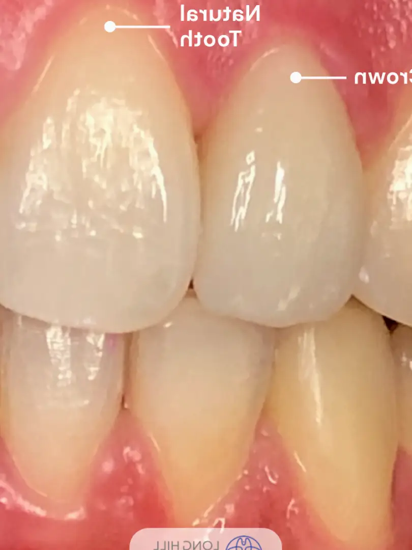 Gillette Long Hill Dental