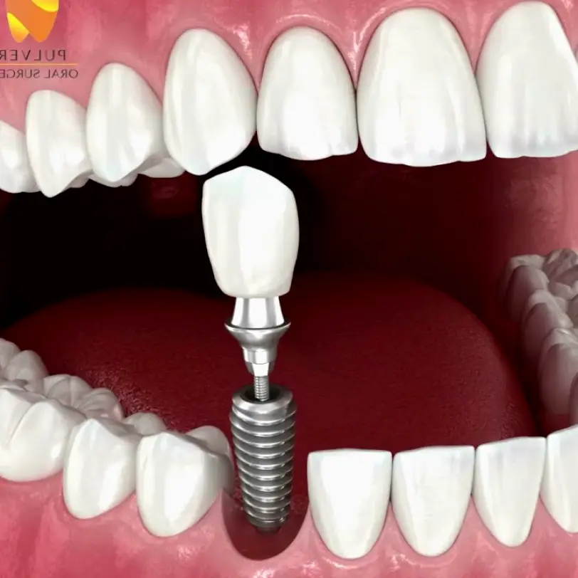 Highland Pulver Oral Surgery